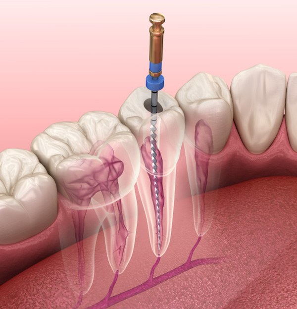Woman smiling at the dentist